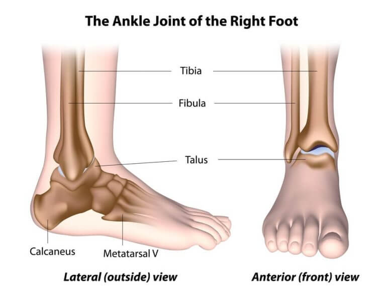 Do I Need Physio for My Sprained Ankle?